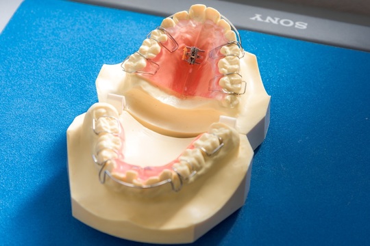 ♡OrthoPulse 矯正治療サポートデバイス オーソパルス® - 矯正歯科 | おちデンタルクリニック長久手